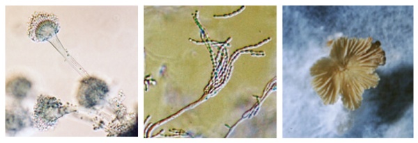 アスペルギルス・フミガタス（左）、屋外や屋内に浮遊しているコウジカビの一種。アレルギーのほか、肺や気管支の炎症の原因に。アスペルギルス・レストリクタス（中）、乾燥に強く、屋内のほこりや書籍などにつくコウジカビの一種。アレルギーの原因になる（カビ写真提供：川上部長）。カビと同じ真菌のキノコが気管内にすみ着く症例も（右）（キノコ写真提供：亀井教授）
