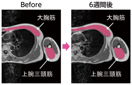 MRI画像提供：小笠原准教授