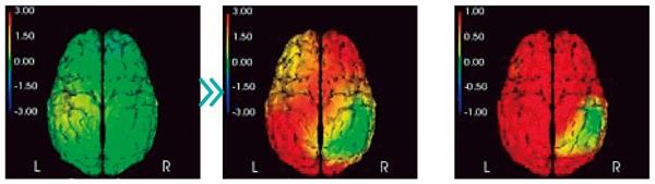 脳波の状態。左から、顔もみ前、顔もみ後、顔もみ前後の差