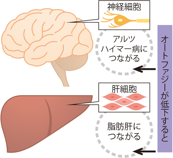 脂肪肝、アルツハイマーにもオートファジーの低下が関わる