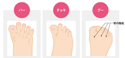 足のグーチョキパーは足の内在筋トレーニングの一つ。チョキは親指を下にする方法もできるといい。左右とも、グーチョキパーを10回ずつ繰り返す