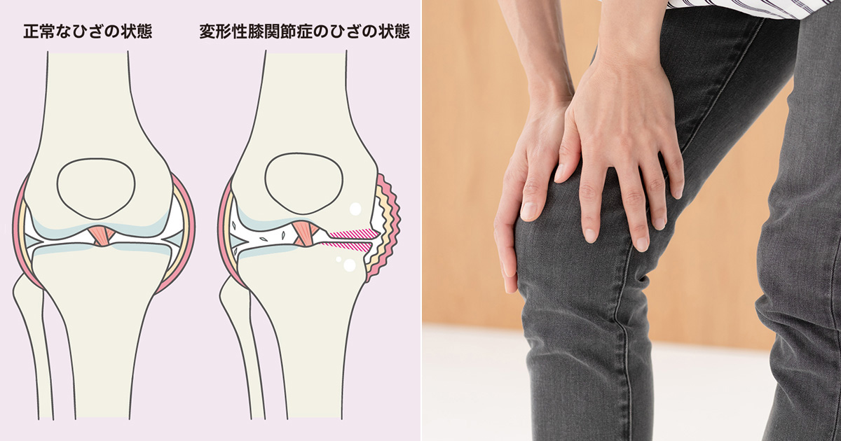 日経ヘルス：日経xwoman