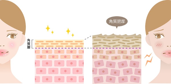 顔のくすみは5タイプ マスクで隠さず、しっかりケアを (2ページ目):日経xwoman