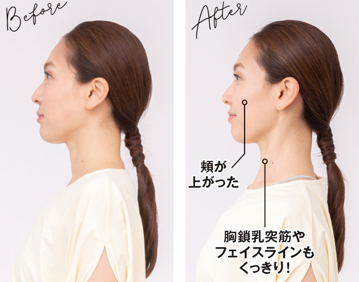 横手貞一朗がモデルに教える ほうれい線を消す「あご筋リフト」 （2