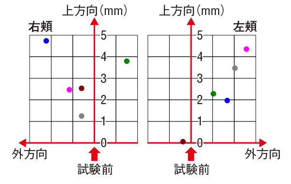 頬の最も高い位置が上昇