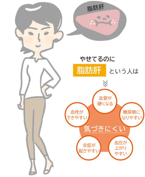 日本人には肥満でないのに脂肪肝の人も多い。このタイプは、内臓脂肪が少なくても脂肪細胞や骨格筋でインスリンの効きが悪くなる。女性の場合は肝臓の線維化や、筋肉内に脂肪がたまる筋脂肪化も進みやすい。