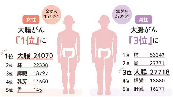 大腸がんの死亡数予測（2021年）女性で1位、男性で3位に