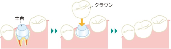 <span class="bgColShadeA bgColYellow fontSizeM textColBlack">クラウン</span>
