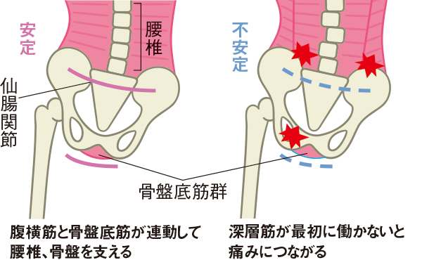 じわっとがカギ 腰痛を改善する腹横筋の正しい使い方 （2ページ