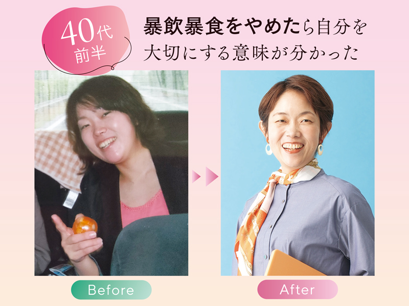 横手貞一朗がモデルに教える ほうれい線を消す「あご筋リフト」：日経