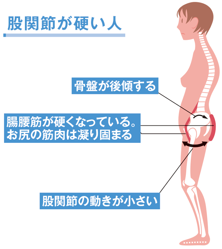 股関節が硬いと 老け見え猫背に 骨盤ヨガ で改善 2ページ目 日経xwoman