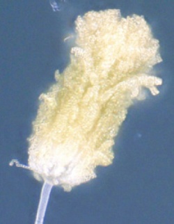 麹菌の胞子（写真：中島教授）