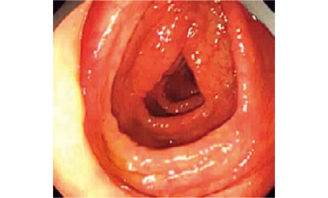 リラックスした状態の腸管内(写真提供/水上部長)