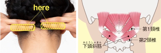 写真)首の付け根にある頭蓋骨の下端から両手の指を2本ずつそろえて当てる。このうち、人さし指が触れる部分に「下頭斜筋」がある。イラスト)首の第1・第2頸椎を斜めにつなぐのが「下頭斜筋」。首を横にひねる「回旋」の動きを担い、首が前傾したスマホ姿勢で左右に目を動かすと、特に固まりやすい
