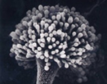 麹菌の顕微鏡写真