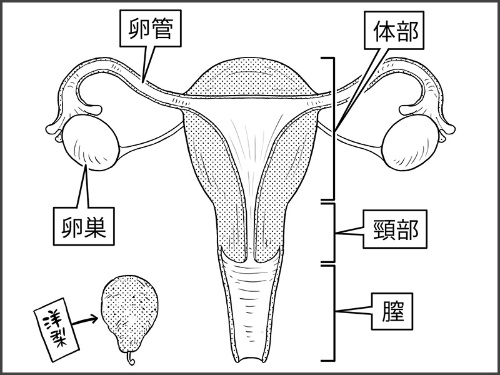 子宮の図。子宮は、洋梨をひっくり返したような形の臓器です