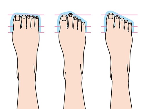 一般的な足の形。左から、スクエア型、ギリシャ型、エジプト型。どの指が一番長いのかが判断基準となる。日本人に最も多いのは、親指が長いエジプト型。<br>（イラスト／hiro）