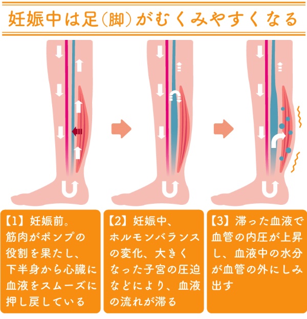 むくみ 手のしびれ 妊娠中の手足のトラブルへの対処法 2ページ目 日経xwoman むくみ 手のしびれ 妊娠中の手足のトラブルへの対処法 2ページ目 日経xwoman