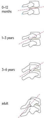 首の骨は、幼い子どもの水平な頸椎骨から鞍部型をした大人の形状への数年かけて次第に変形・成長する。鞍部型をしているのは、頭部が前方に投げ出されたときに、頸椎骨が連動して支え合うため。幼い子どもはこの防御装置が十分ではない